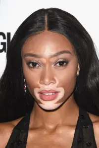 Фото  (Winnie Harlow)