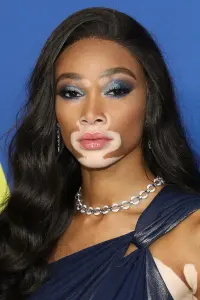 Фото  (Winnie Harlow)