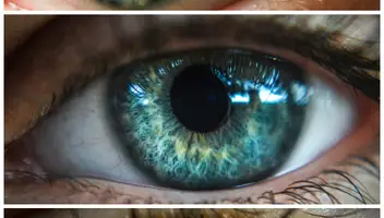 В пошуку моделей з цікавою гетерохромією очей